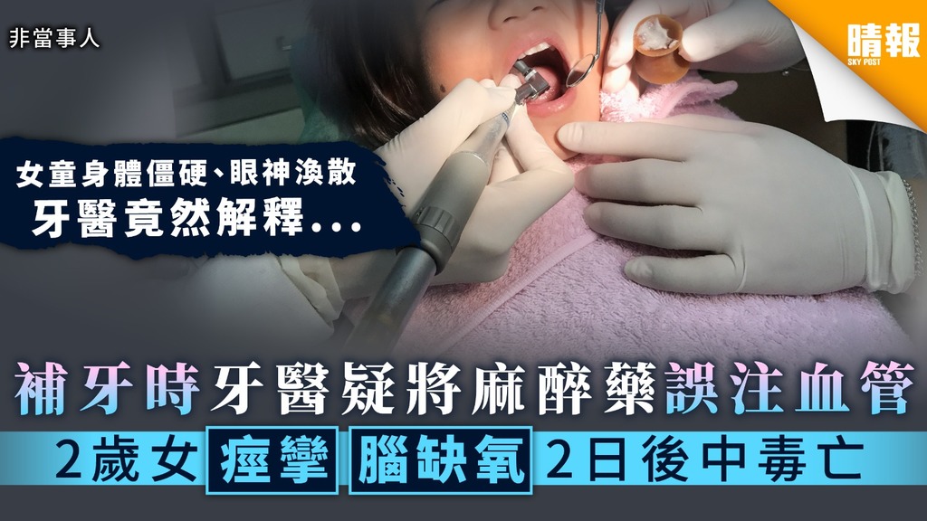 【醫療事故】補牙時牙醫疑將麻醉藥誤注血管 2歲女痙攣腦缺氧2日後中毒亡
