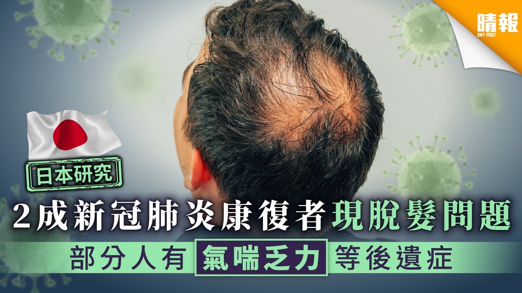 【新冠肺炎．日本研究】2成新冠肺炎康復者現脫髮問題 部分人有氣喘乏力等後遺症