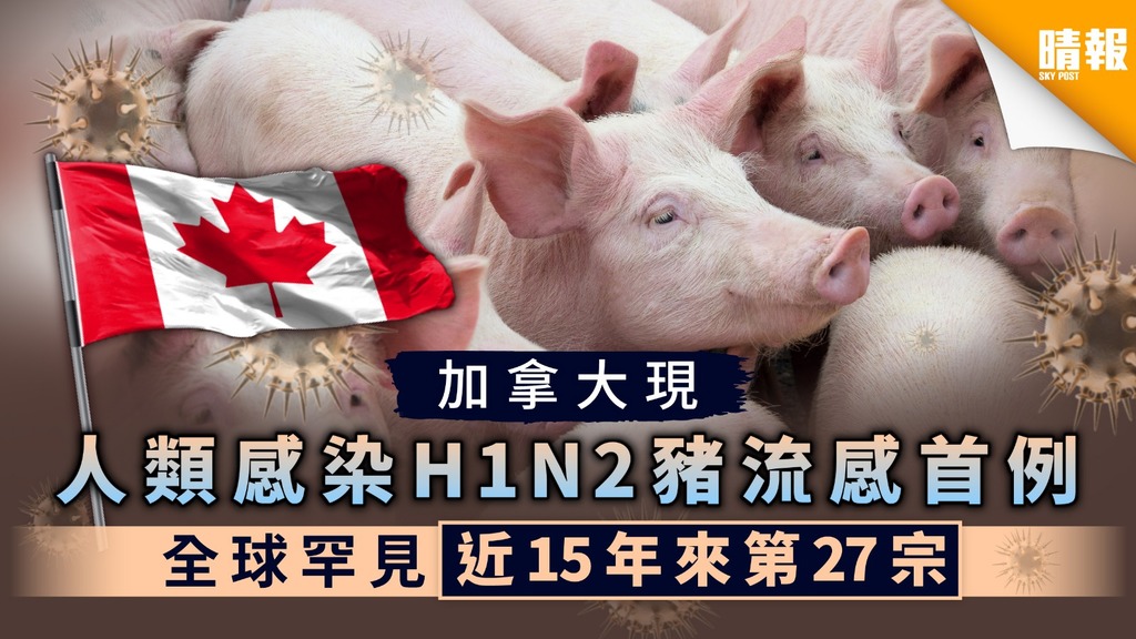【豬流感】加拿大現人類感染H1N2豬流感首例 全球罕見近15年來第27宗