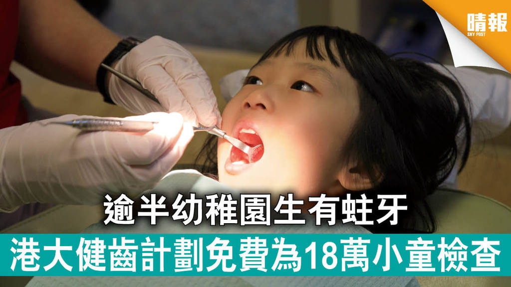 【小心蛀牙】逾半幼稚園生有蛀牙 港大健齒計劃免費為18萬小童檢查