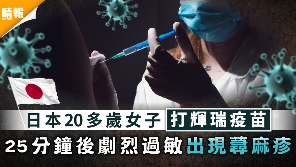 新冠疫苗｜日本第二宗打輝瑞後過敏 20多歲女子出現蕁麻疹 