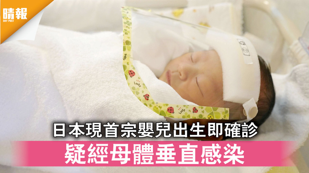 新冠肺炎｜日本現首宗嬰兒出生即確診 疑經母體垂直感染