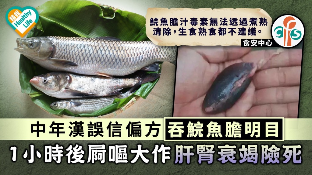 食用安全｜中年漢誤信偏方吞鯇魚膽明目 1小時後屙嘔大作肝腎衰竭險死