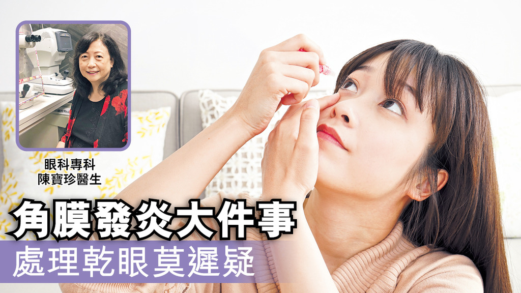 角膜發炎大件事 處理乾眼莫遲疑