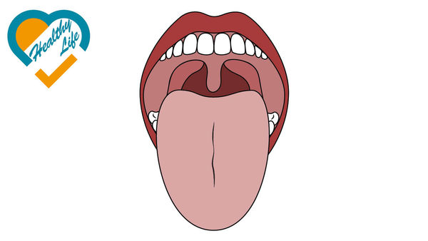 健康舌色應淡紅 變深色或積熱