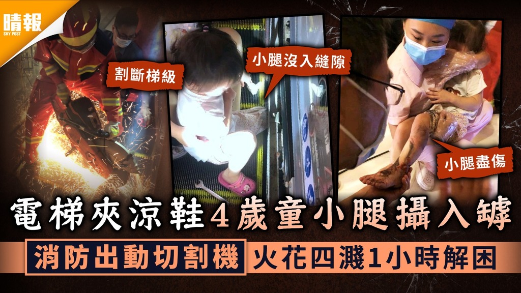 電梯意外｜電梯夾涼鞋4歲童小腿攝入罅 消防出動切割機火花四濺1小時解困
