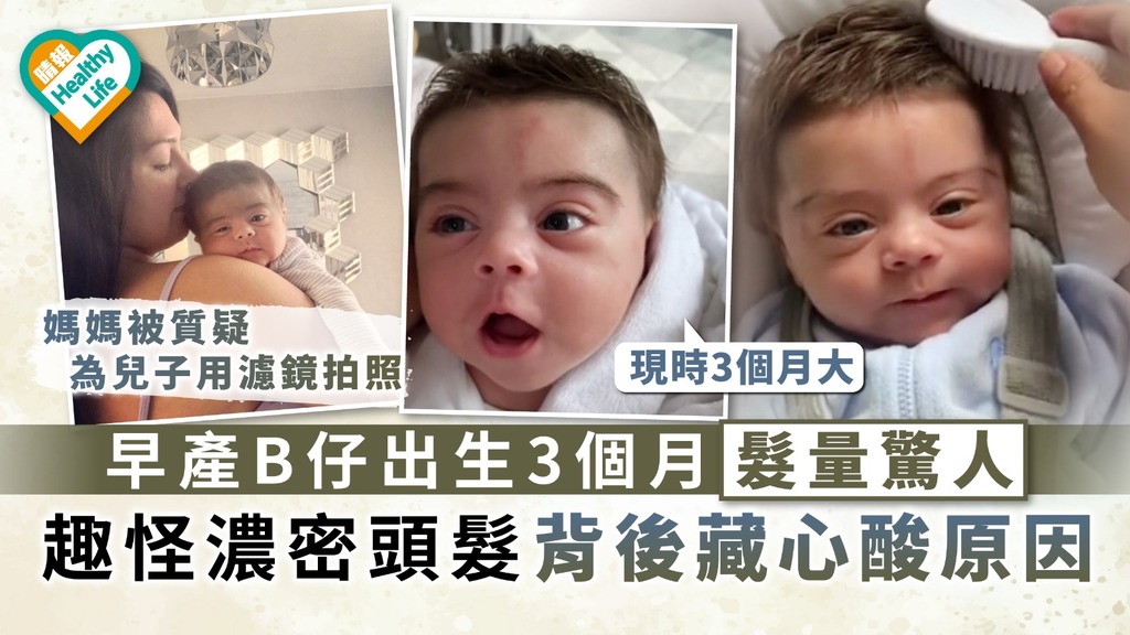 藥物副作用｜早產B仔出生3個月髮量驚人 趣怪濃密頭髮背後藏心酸原因