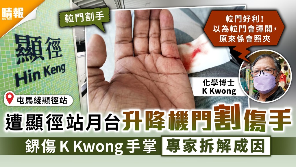 升降機意外｜遭顯徑站月台升降機門割傷手 鎅傷K Kwong手掌 專家拆解成因