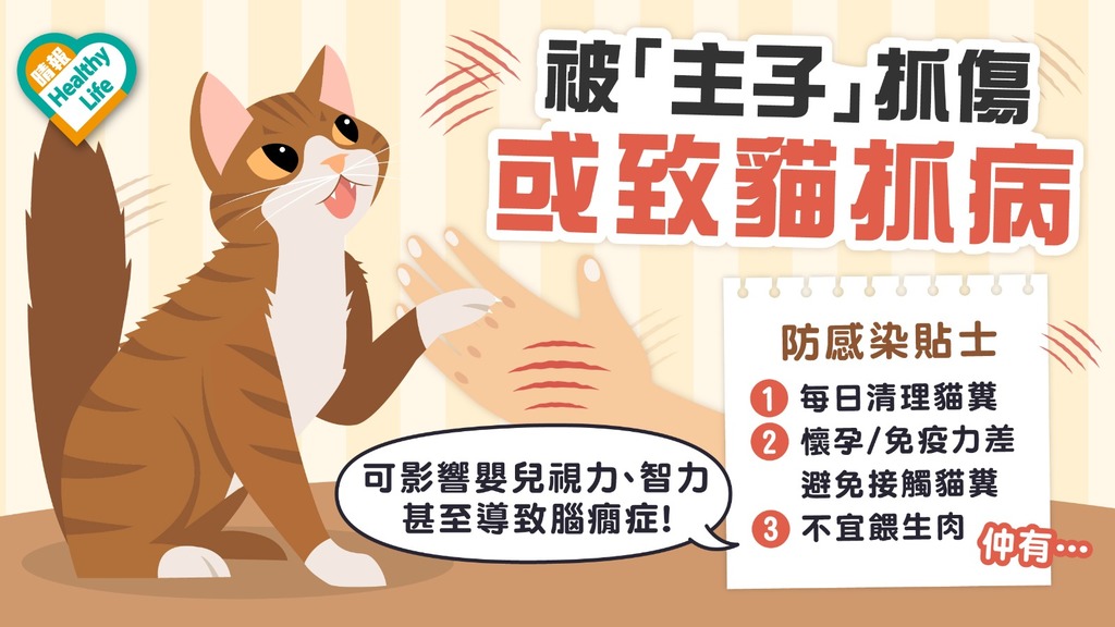 貓奴注意 │ 「喵星人」或帶病原體 「貓抓病」可致淋巴腫痛 染弓形蟲恐傷胎兒