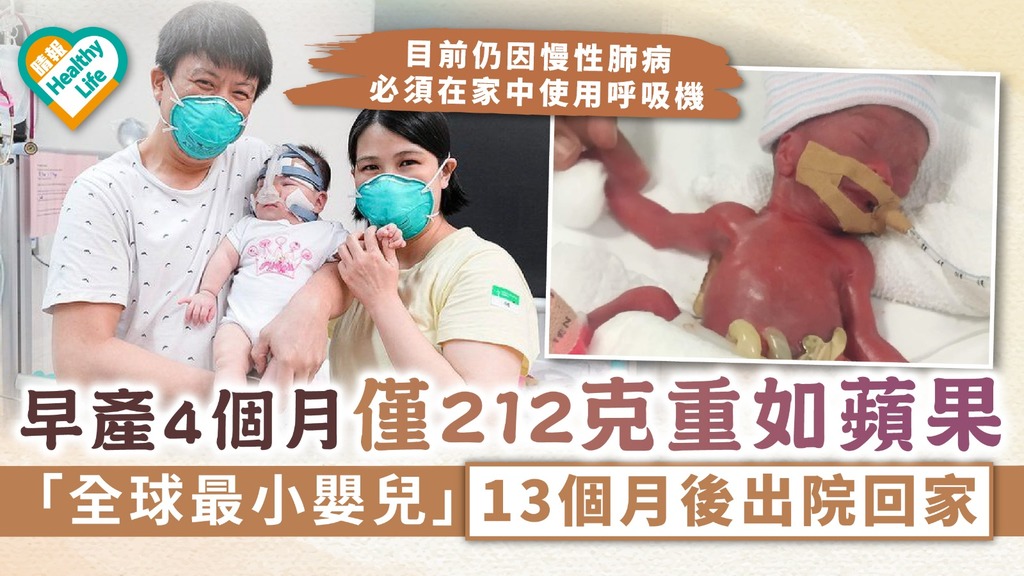 生命小鬥士｜早產4個月僅212克重如蘋果 「全球最小嬰兒」13個月後出院回家