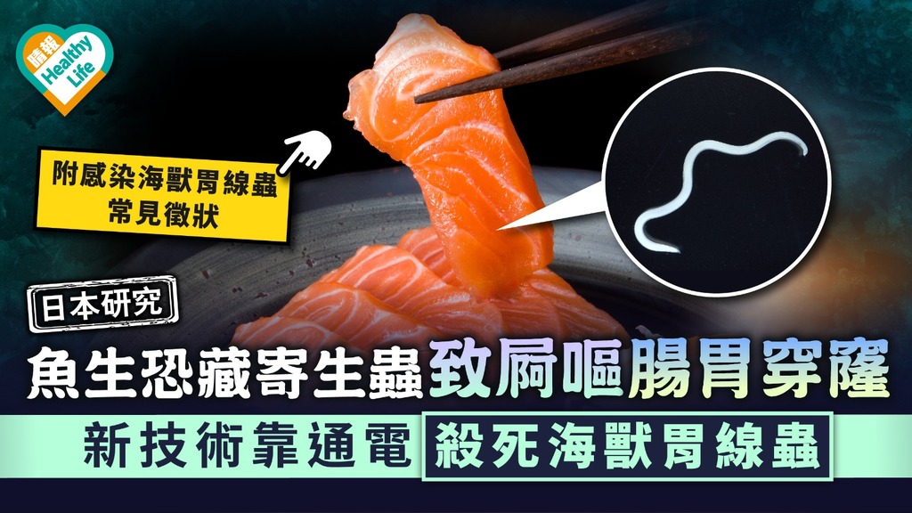 日本研究｜魚生恐藏寄生蟲致屙嘔腸胃穿窿 新技術靠通電殺死海獸胃線蟲｜附感染症狀
