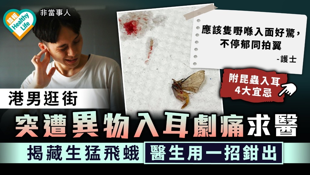 昆蟲入耳｜港男逛街突遭異物入耳劇痛求醫 揭藏生猛飛蛾醫生用一招鉗出｜附昆蟲入耳4大宜忌