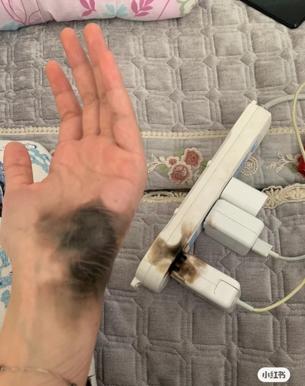 家居安全 電腦充電器插拖板 啪 一聲爆炸女生手腕熏黑疑戴手鏈插電惹禍 晴報 家庭 家居 D