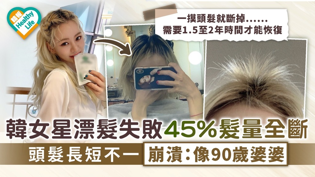 漂髮危機｜韓女星漂髮失敗45%髮量全斷 頭髮長短不一崩潰：像90歲婆婆