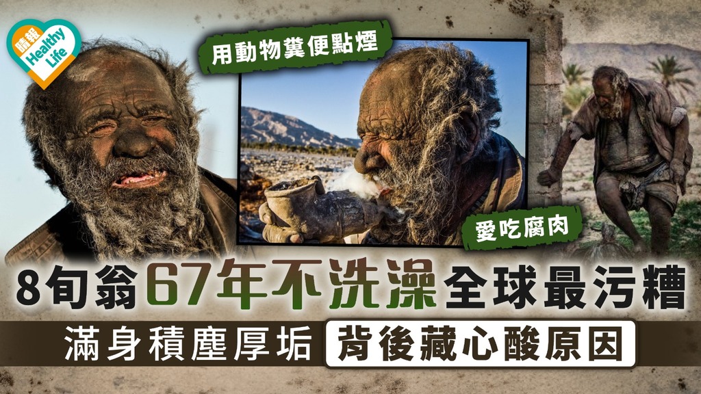 伊朗怪人｜8旬翁67年不洗澡全球最污糟 滿身積塵厚垢背後藏心酸原因