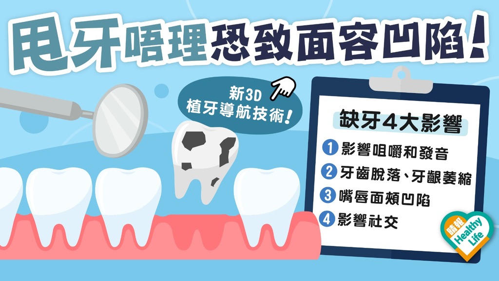 牙齒健康 │ 甩牙懶去補愈甩愈多 礙發音進食 致面容凹陷 