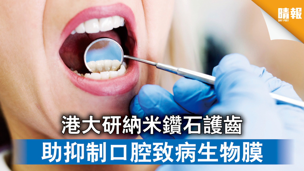 牙齒健康 │港大研納米鑽石護齒 助抑制口腔致病生物膜