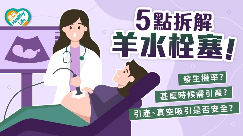 羊水栓塞｜產婦憂引產致羊水栓塞 婦產科學院稱罕見 緊急時不引產更危險