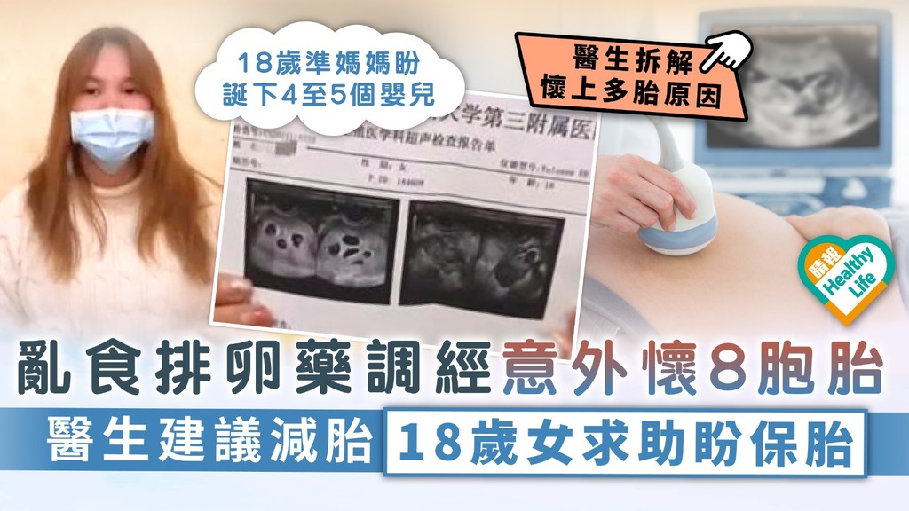 多胞胎︳亂食排卵藥調經意外懷8胞胎 醫生建議減胎 18歲女求助盼保胎