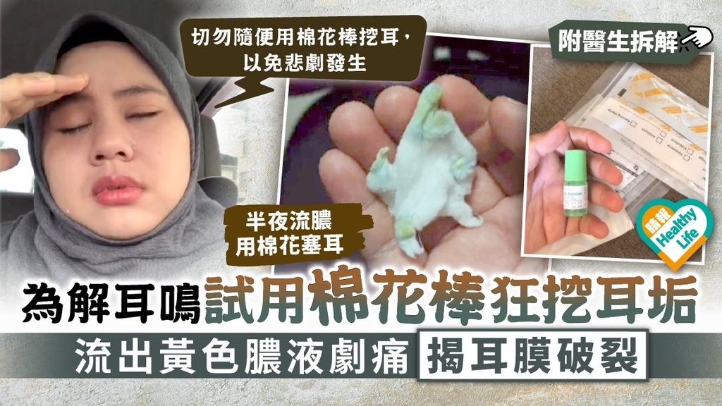 挖耳惹禍︳為解耳鳴試用棉花棒狂挖耳垢 流出黃色膿液劇痛揭耳膜破裂︳附醫生拆解