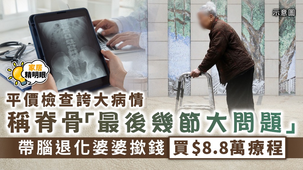 家居精明眼 ︳平價檢查誇大病情稱脊骨「最後幾節大問題」 帶腦退化婆婆撳錢買$8.8萬療程
