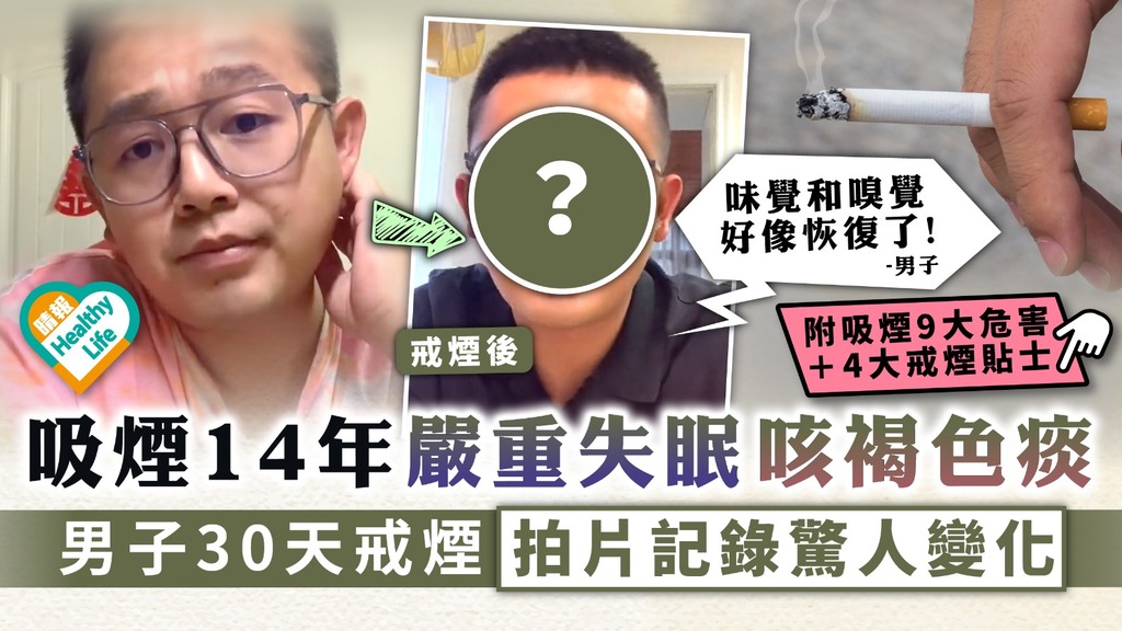 決心戒煙︳吸煙14年嚴重失眠咳褐色痰 男子30天戒煙拍片記錄驚人變化︳附吸煙9大危害+4招戒煙