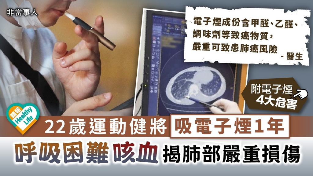 損害健康︳22歲運動健將吸電子煙1年 咳血呼吸困難揭肺部嚴重損傷︳附電子煙4大危害
