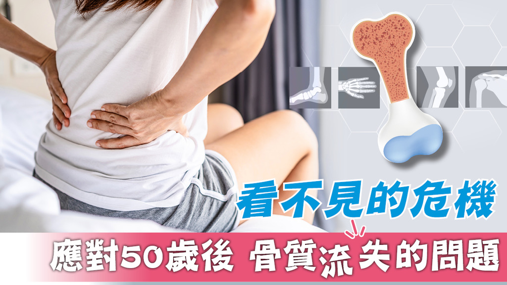 看不見的危機 應對50歲後骨質流失的問題