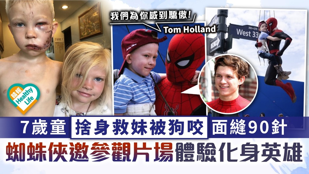 手足情深︳7歲童捨身救妹被狗咬面縫90針 蜘蛛俠Tom Holland邀參觀片場 體驗化身英雄