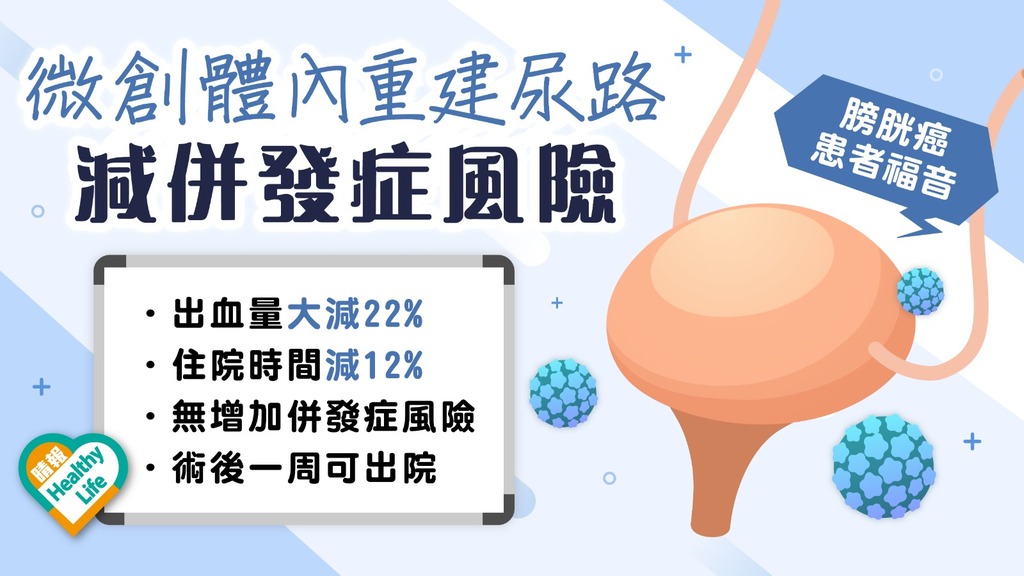 膀胱癌 │ 微創體內重建尿路失血量少 減併發症風險 膀胱癌患者術後康復更快