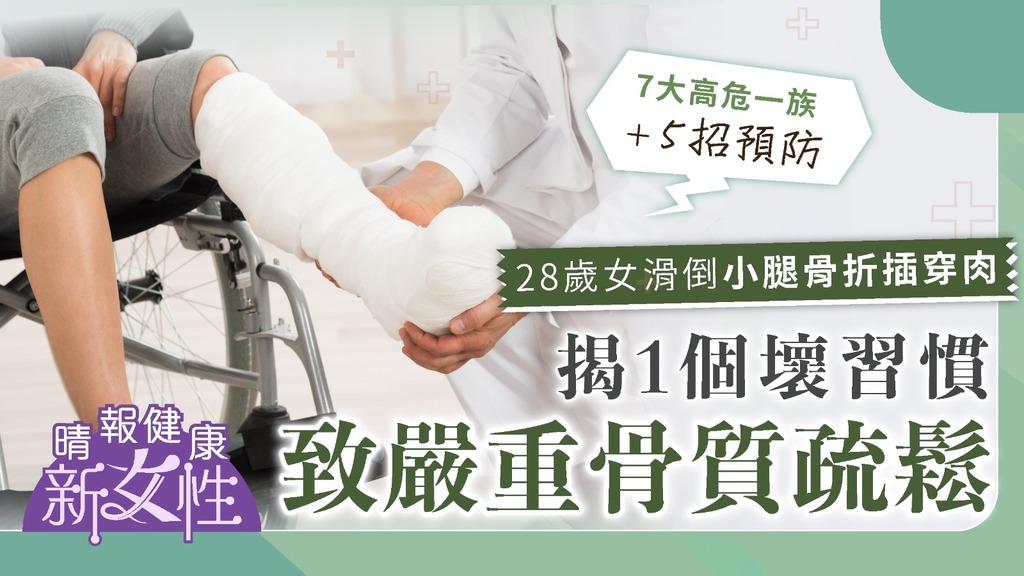 健康新女性︳28歲女滑倒小腿骨折插穿肉 揭1個生活壞習慣致嚴重骨質疏鬆︳附7大高危一族＋5招預防