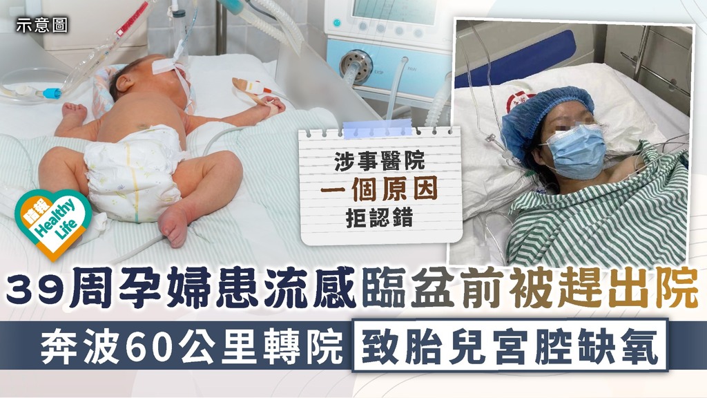 母嬰安全︳39周孕婦患流感臨盆前被趕出院 奔波60公里轉院致胎兒宮腔缺氧