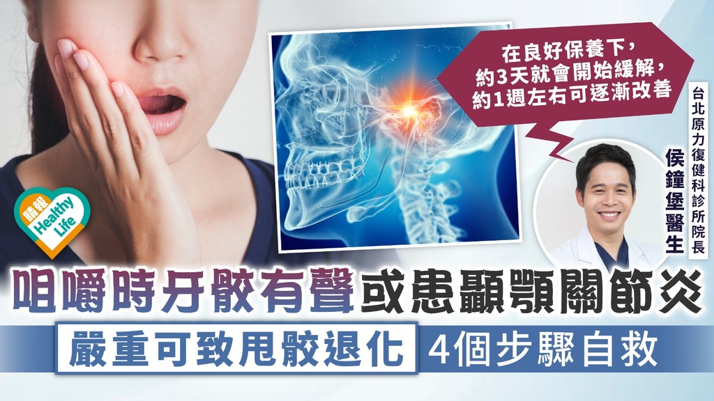 關節炎 ︳咀嚼時牙骹有聲或患顳顎關節炎 嚴重可致甩骹退化4個步驟自救【附8大徵狀】