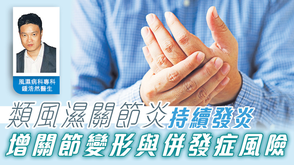 類風濕關節炎持續發炎 增關節變形與併發症風險