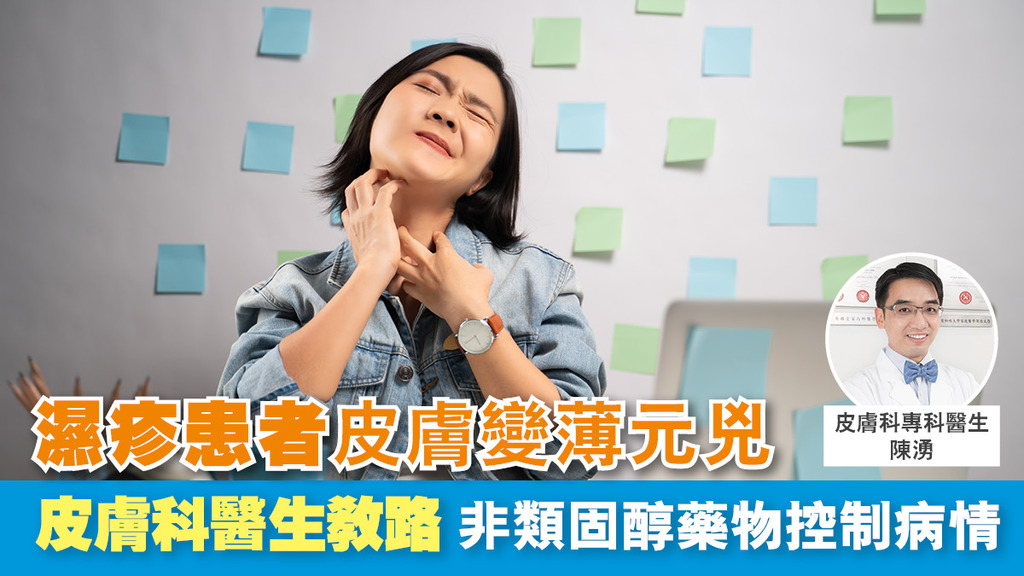 濕疹患者皮膚變薄元兇 皮膚科醫生教路 非類固醇藥物控制病情