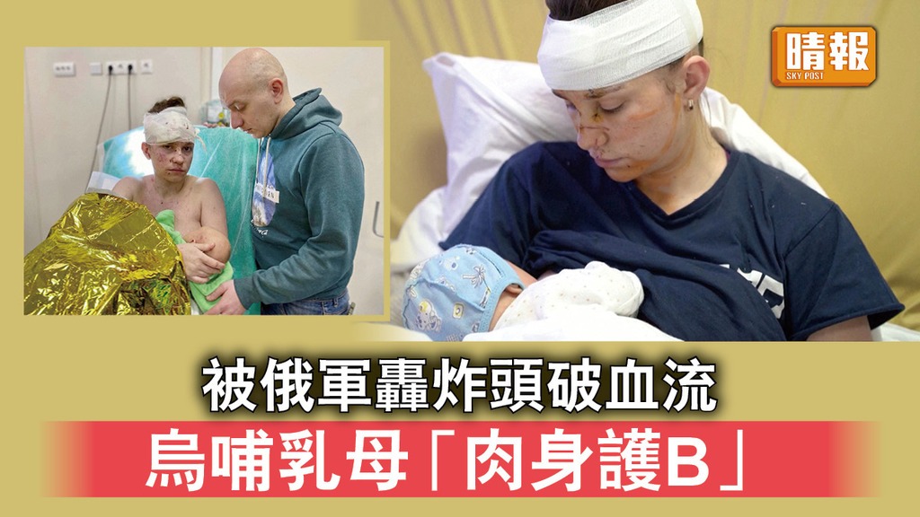 烏克蘭危機｜被俄軍轟炸頭破血流    烏哺乳母「肉身護B」
