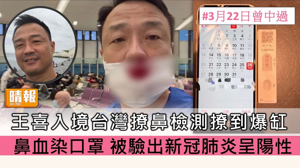 王喜入境台灣撩鼻檢測撩到爆缸 血染口罩後被驗出新冠肺炎呈陽性