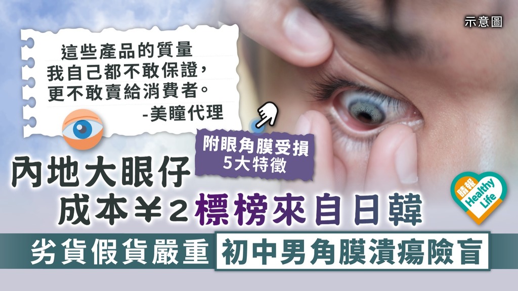 有色隱形眼鏡︳內地大眼仔成本¥2標榜來自日韓 劣貨假貨嚴重初中男角膜潰瘍險盲