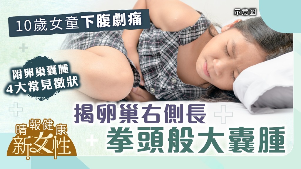 健康新女性︳10歲女童下腹劇痛 揭卵巢右側長拳頭般大囊腫︳附卵巢腫瘤4大徵狀