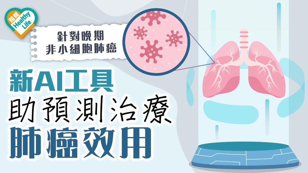 癌症治療｜中大聯同南韓3大學研AI分析工具 助預測晚期非小細胞肺癌治療效用