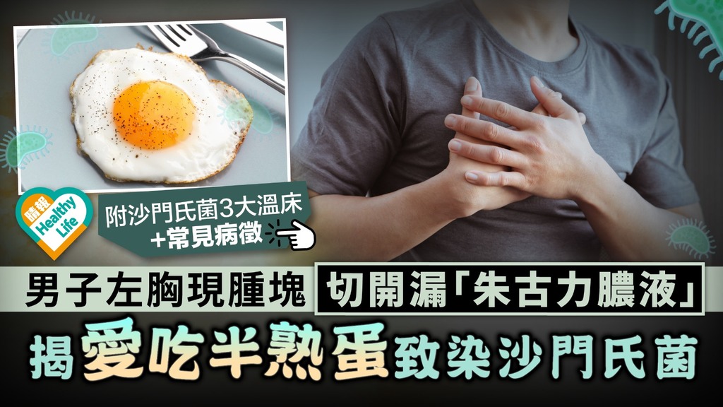 食用安全︳男子左胸現腫塊切開漏「朱古力膿液」 揭愛吃半熟蛋致染沙門氏菌