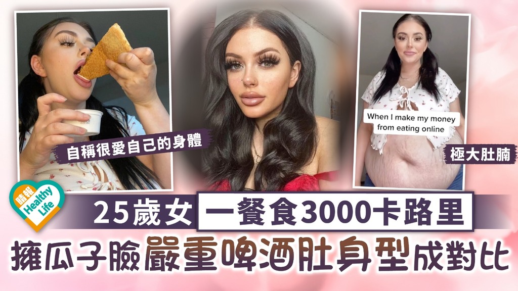 肥胖問題︳25歲女靠拍片暴食月賺$10萬 瓜子臉卻擁巨型啤酒肚對比強烈