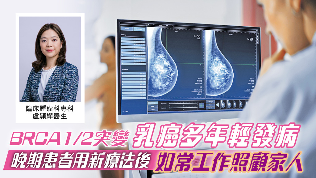 BRCA1/2突變乳癌多年輕發病 晚期患者用新療法後如常工作照顧家人