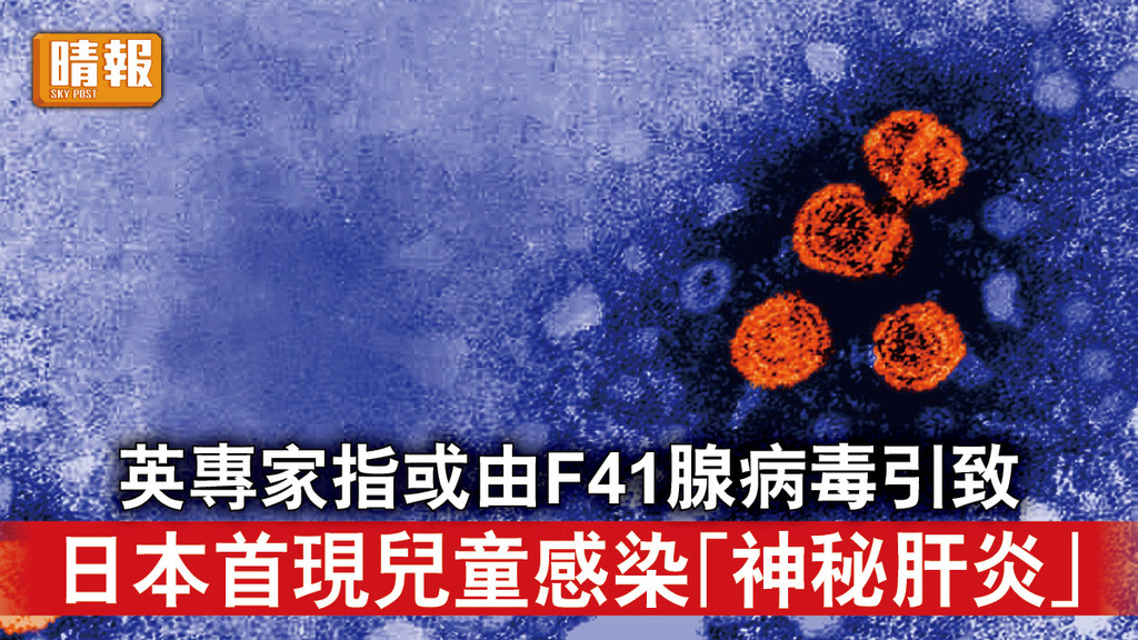 神秘肝炎｜英專家指或由F41腺病毒引致  日本首現兒童感染「神秘肝炎」