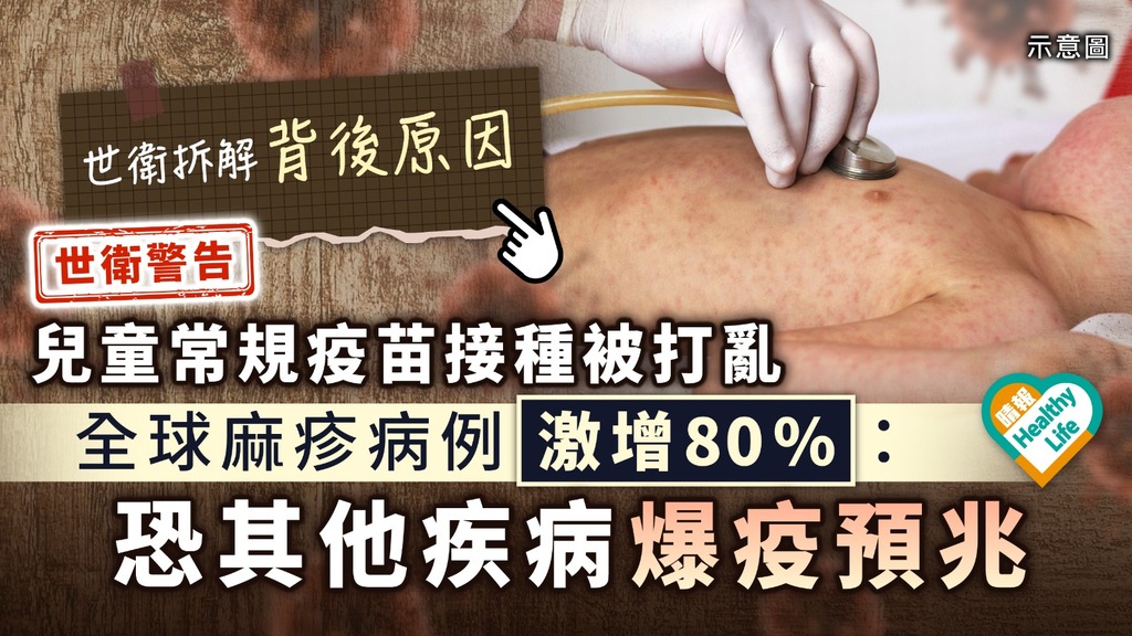 疫症危機︳世衛警告兒童常規疫苗接種被打亂 全球麻疹病例激增80%：恐其他疾病爆疫預兆