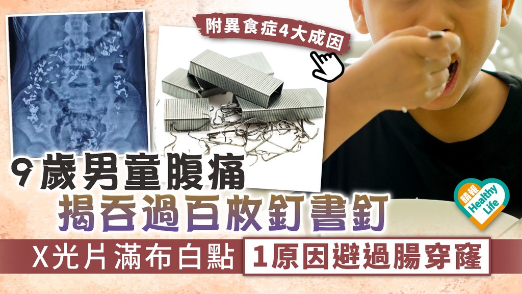 異食症︳9歲男童腹痛揭吞過百枚釘書釘 X光片滿布白點1原因避過腸穿窿︳附異食症4大成因