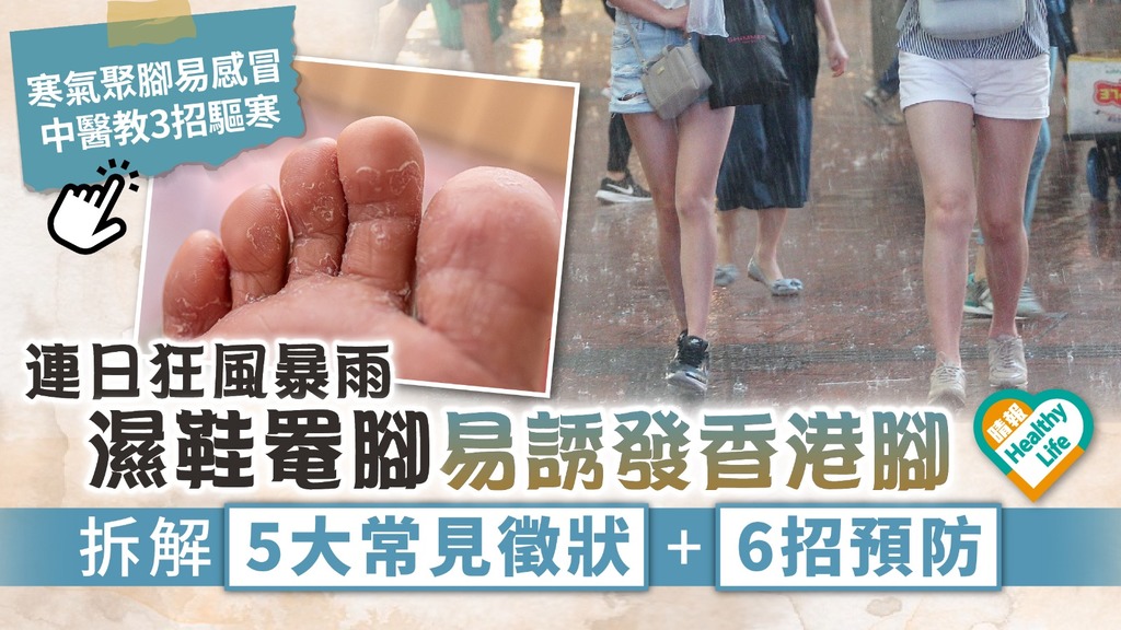 下雨天︳連日狂風暴雨 濕鞋罨腳易誘發香港腳 拆解5大常見徵狀+6招預防︳另附驅寒方法