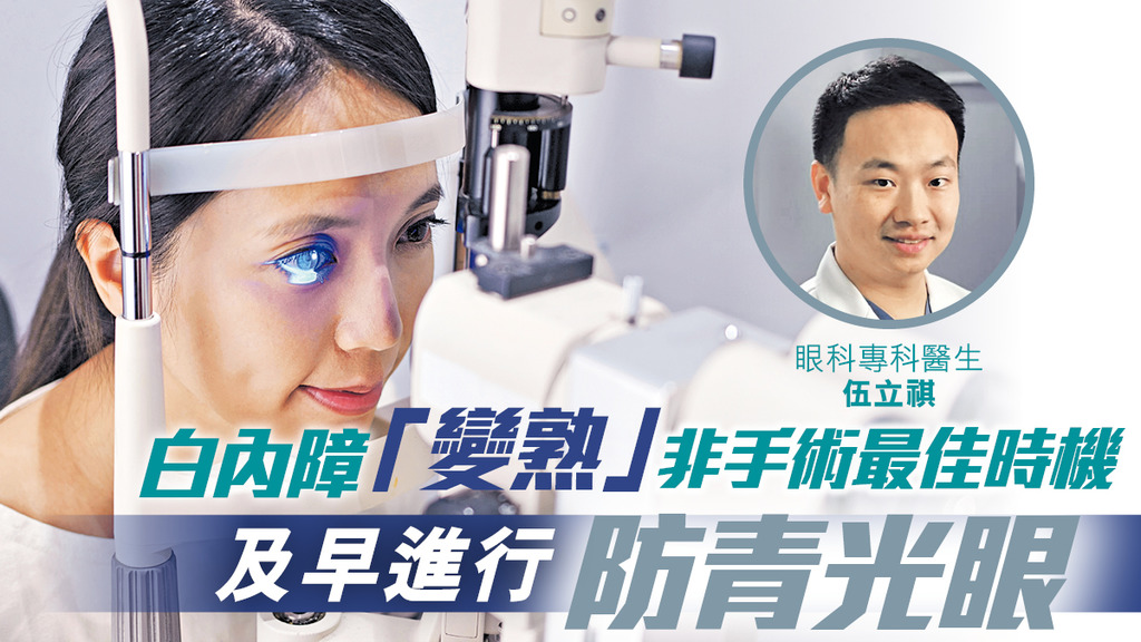 白內障「變熟」非手術最佳時機 及早進行防青光眼