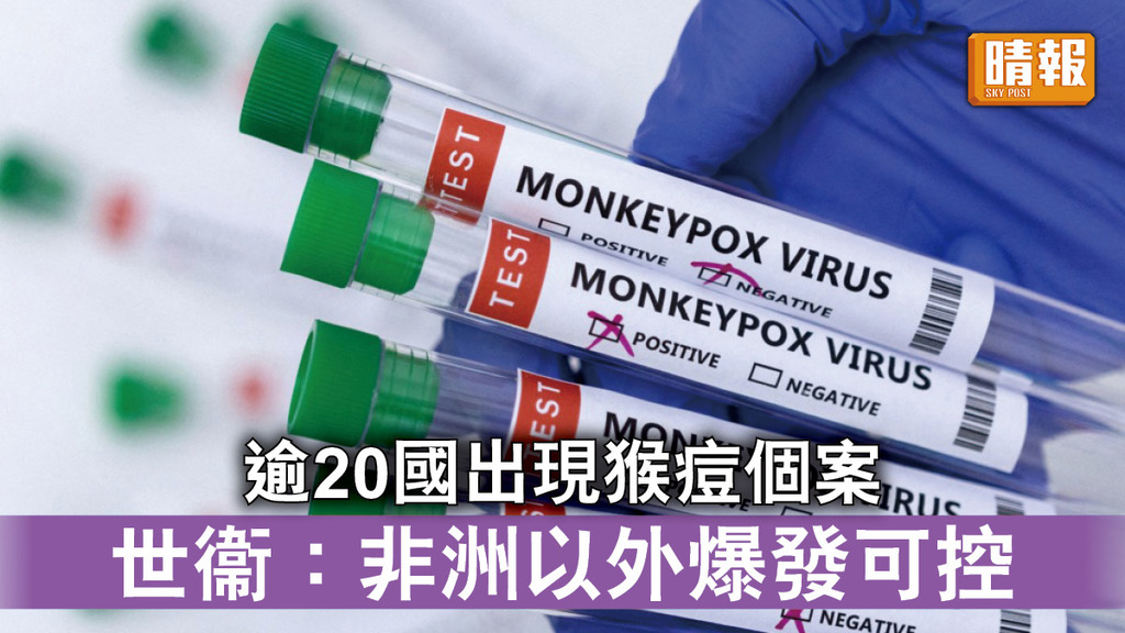 猴痘｜逾20國出現猴痘病毒個案 世衞相信非洲以外爆發可控