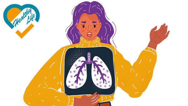 MET基因突變肺癌易轉移 非煙民也中招